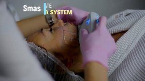 Смас лифтинг видео о процедуре