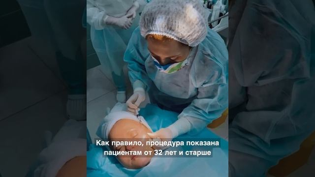 Лифтинг нитями АПТОС