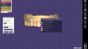 Как вывернуть наизнанку файл STL в ExoCad