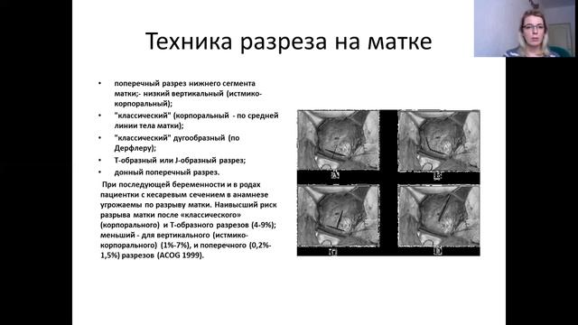 Кесарево сечение.mp4