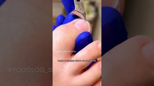 Как правильно стричь ногти детям?