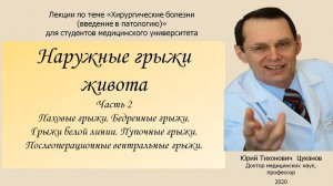 Наружные грыжи живота, часть 2. Лекция для студентов медуниверситета .