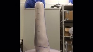 Протез голени