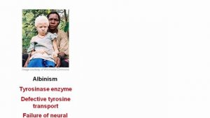 USMLE RX - 8.Анатомия - 2.Дерматология - 8.Пигментные Заболевания Кожи