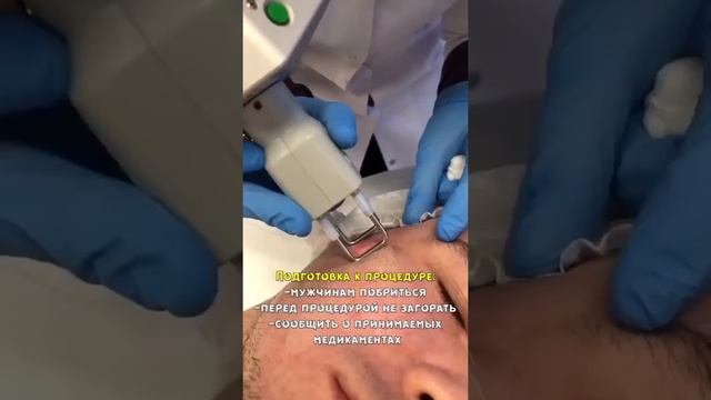 Лазерная шлифовка лица со скидкой 50% в эстетик-центре "Облака" смотреть онлайн