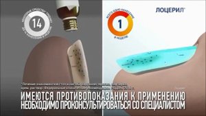 Реклама Лоцерил - Март 2019