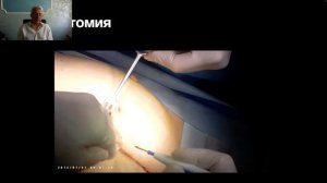 Клинический случай: Просто закрытие стопы