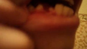 КАК ПРАВИЛЬНО ВЫДРАТЬ САМОМУ ЗУБ БЕЗ БОЛИ