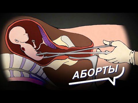 Имеет ли женщина право убить нерожденного ребенка? За и Против абортов. Шоу: Все говорят об этом