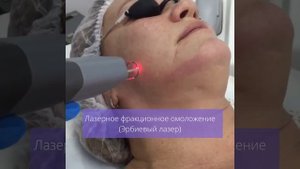 Лазерное омоложение лица. Эрбиевый лазер.mp4