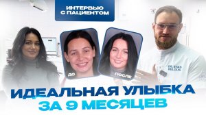 Отзыв пациента после 9 месяцев работы над улыбкой. Стоматолог Стас Белоус, Ульяновск