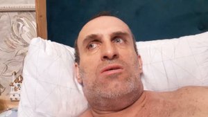 2 мая 2022 г.. Тяжелое состояние на 3-й неделе лучевой терапии. #рак #уменярак #онкология