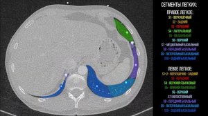 Сегменты легких / Компьютерная томография / Пульмонология
