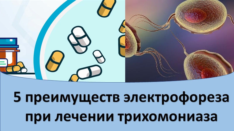 Электрофорез в лечении трихомониаза