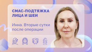 СМАС-подтяжка лица и шеи. Инна. Вторые сутки после операции