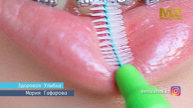 Здоровая улыбка от Марии Гафаровой 1й выпуск