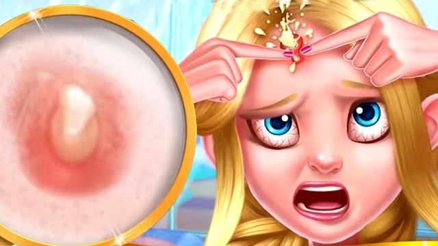 Что будет, если давить прыщи смотреть онлайн