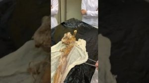 Мышцы верхней конечности, Топография. Соколова Е.А.