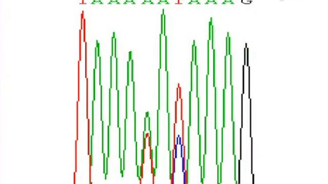 Isolating Potentiated Hsp104 Variants Using Yeast Proteinopathy Models l Protocol Preview смотреть онлайн