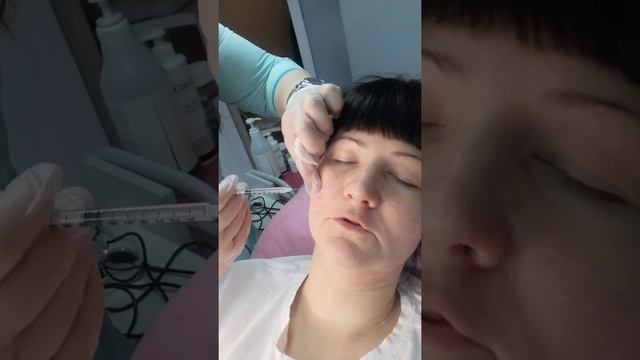 Липолитик Light fit