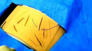 Техника наложения швов