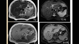 Базовый курс по МРТ  a  Лекция «МРТ печени  анатомия и методика сбора данных»  Лектор  Карельская Н