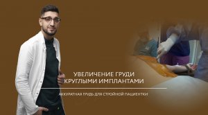 Увеличение груди круглыми имплантами 250 мл