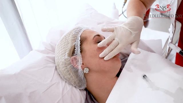 FUSION MESO PLATINUM PEN смотреть онлайн