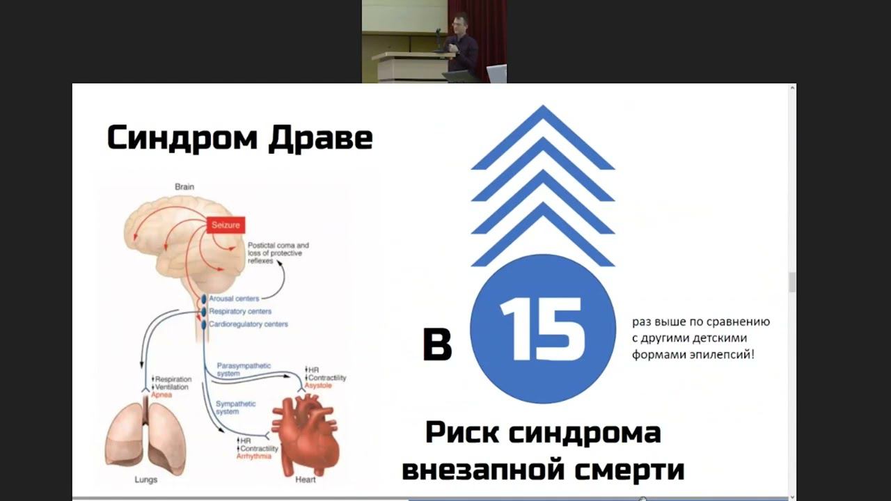 "Вельтищевске пятницы" Синдром Драве