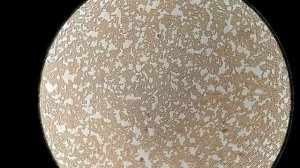 Влияние ТЫКВЫ на кровь человека