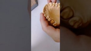 Моделирование зуба воском