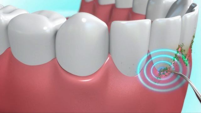 DentaPic Sonic смотреть онлайн