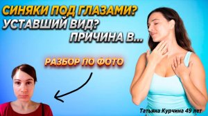 Круги, синяки уставший вид лица? Решение есть!