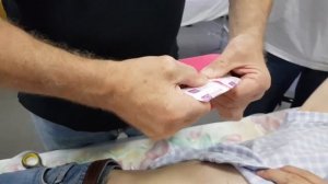 Тейпирование пупочной грыжи.