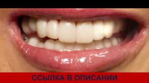 вся правда о винирах сколько стоят виниры виниры отзывы