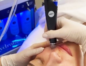 Hydrafacial - аппаратный комплексный уход за кожей