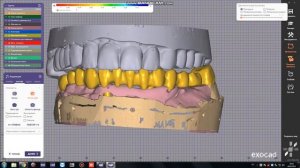 Лазерное спекание каркас