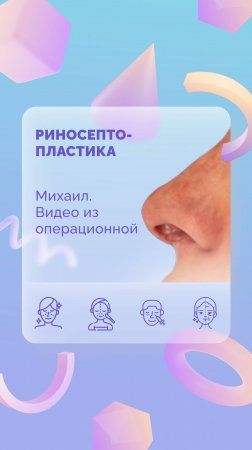 Михаил. Риносептопластика. В операционной