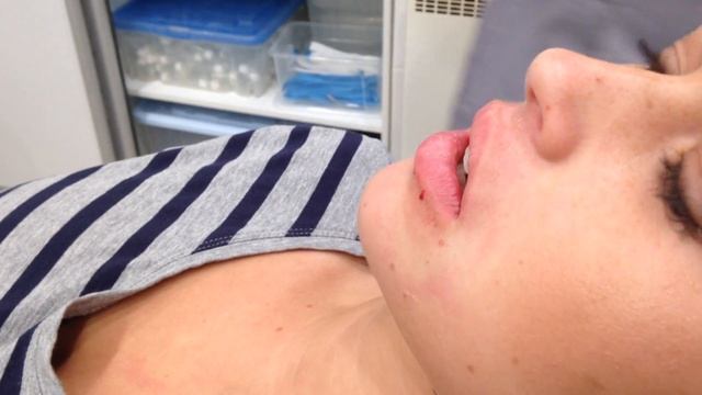 АирисКом: обучение студентов, экзамен по Контурная пластика, губы смотреть онлайн