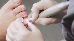 Врач- Подолог. Аппаратный педикюр.Устранение трещин на пятках.