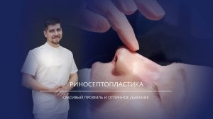 Риносептопластика. Открытая пластика носа и носовой перегородки.