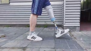 Этапы протезирования нижней конечности