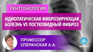 Профессор Сперанская А.А.: Часть 1: идиопатическая фиброзирующая болезнь vs постковидный фиброз