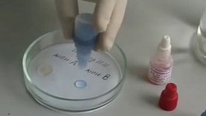 6 3  Определение группы крови с помощью цоликлонов