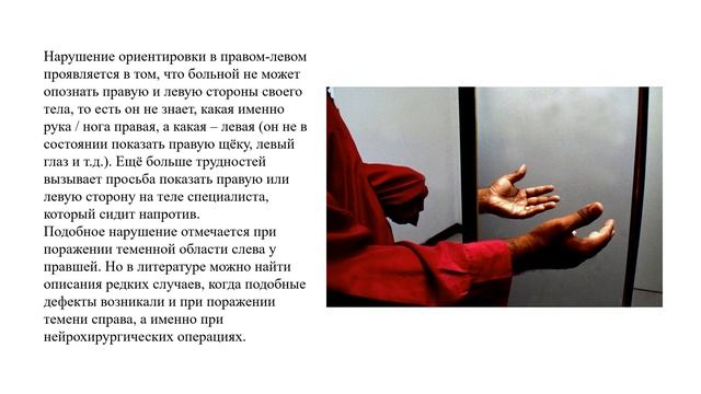 Виды агнозий