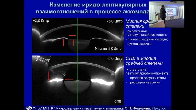 «Пигментная глаукома  Современные представления о патогенезе, лечении и профилактике »