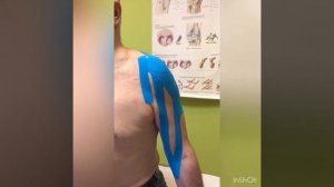 SPACETAPE на длинную головку двуглавой мышцы плеча.