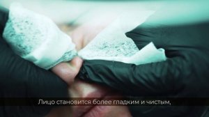 Механическая чистка лица в клинике Dar-Yan