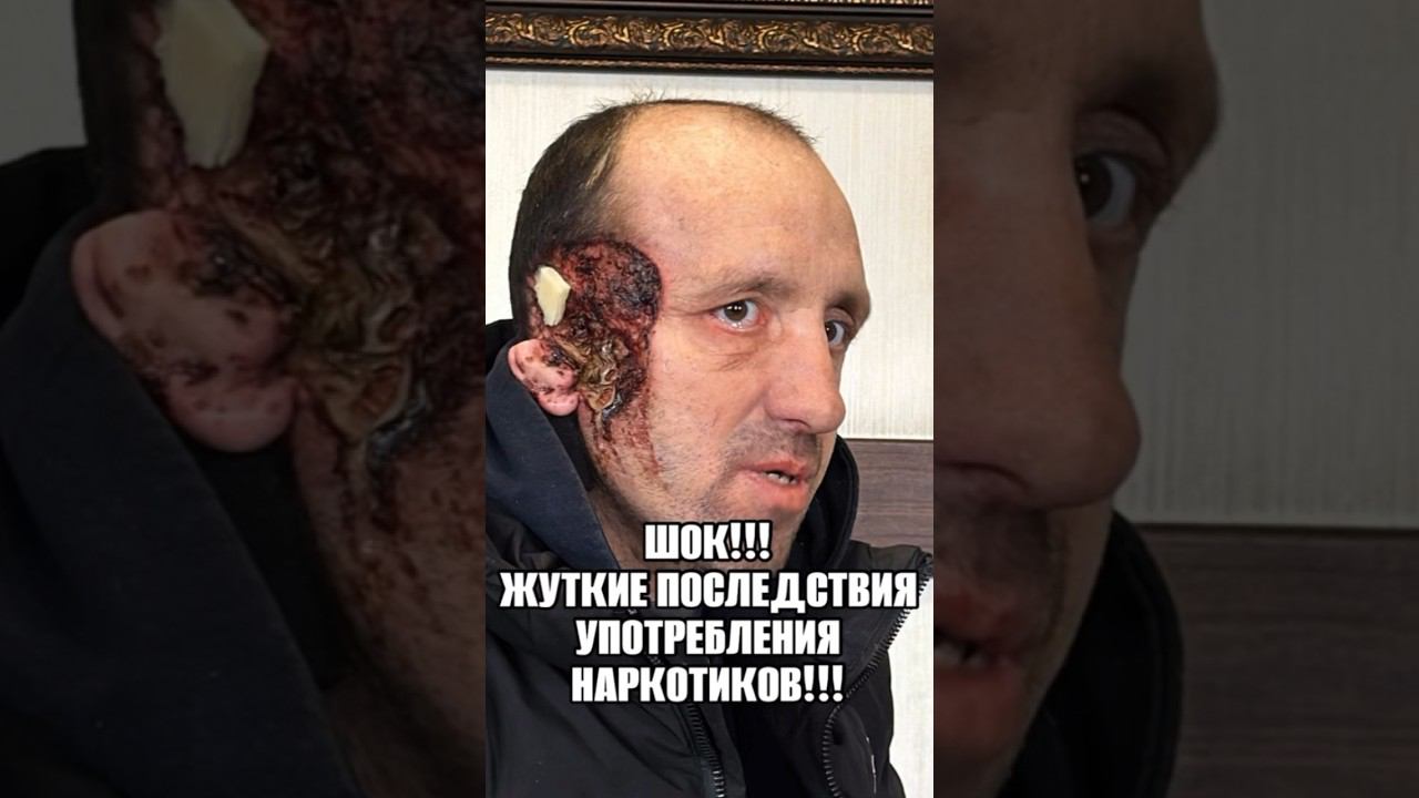 Жизнь центра RedHill42. Последствия употребления наркотиков и алкоголя