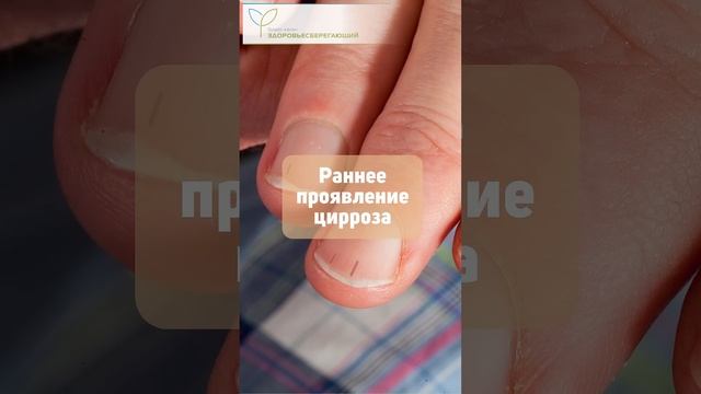 Как печень подаёт сигналы через кожу, ногти и волосы смотреть онлайн